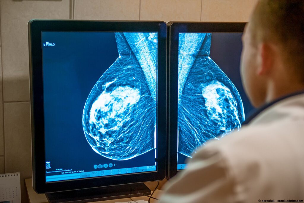 CBD et cancer du sein : un espoir contre l’anxiété liée aux examens médicaux ? CBD et cancer du sein : un espoir contre l’anxiété liée aux examens médicaux ?